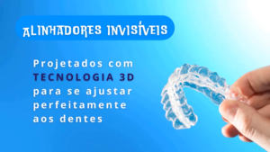 Ort005_Alinhadores transparentes