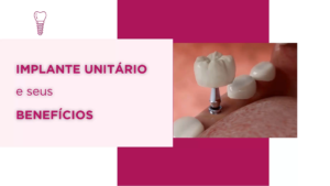 Imp002_Implante Unitário