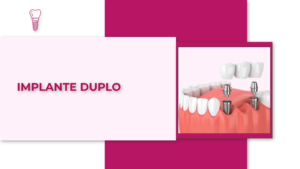 Imp003_Implante duplo