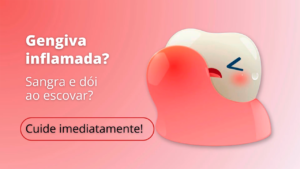 Per005_Gengiva inchada