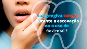 Per007_Gengiva Sangrando