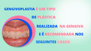 Per006_Gengivoplastia