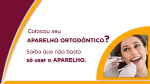Ort003_Manutenção do Aparelho Ortodôntico Fixo